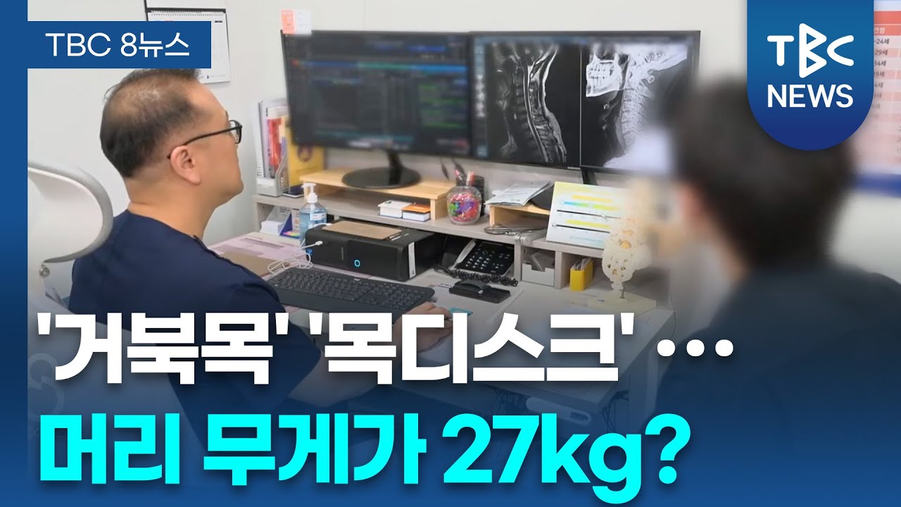 단순 뻐근함이라기엔… ‘경추통’ 주의ㅣ재활의학과 최용민 교수 관련사진