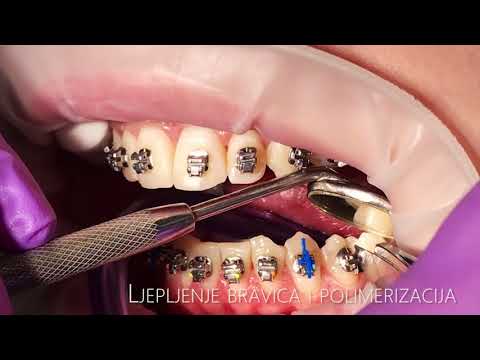 download lagu mp3 mp4 Ortodoncija Ivanec, download mp3 Ortodoncija Ivanec free downloadn, video klip Ortodoncija Ivanec
