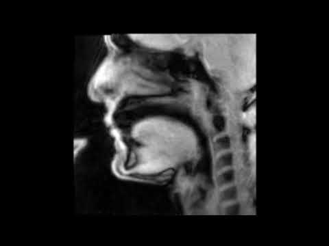 Douglas Yeo, trombone - MRI video 2 - intervals