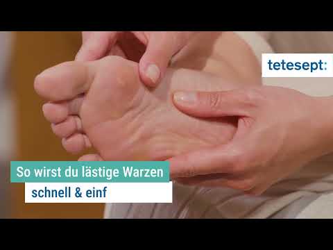 tetesept Warzen Vereiser Tutorial