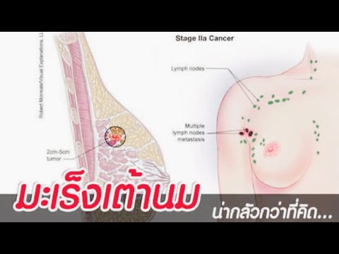 เสื้อผ้าสำหรับหน้าอกเล็กและท้องใหญ่ เต้านมเทียม บริษัท