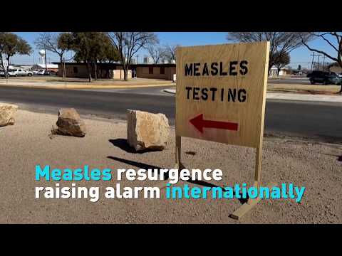 Measles resurgence raising alarm internationally