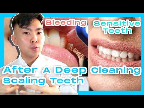 YouTube video about: How long does a deep dental cleaning take?