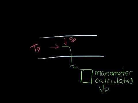 Titus Timeout Podcast   Pressure Basics