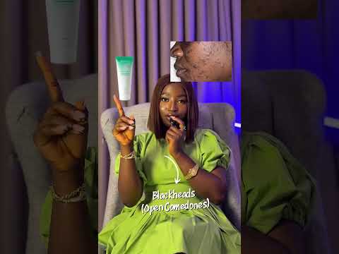 Different types of acne and treatments #acne #acnetreatment #beautytips #skincareregime