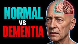 These 7 Dementia Warning Signs Show Up Years Before Diagnosis