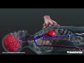 CPR In Action A 3D Look Inside The Body