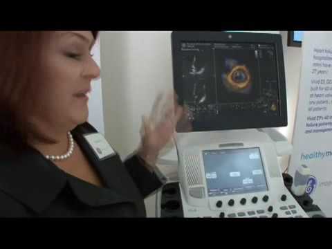 GE VIVID E9   Advanced Cardiac Ultrasound Imaging   4D Heart Imaging
