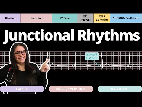Junctional Rhythms on an EKG with Qs | Circulatory System and Disease | NCLEX-RN | Nurse Cheung