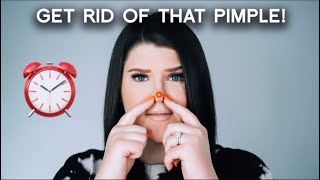 How To Get Rid Of Pimples OVERNIGHT | Fast and Easy Ways To Remove Pimples!