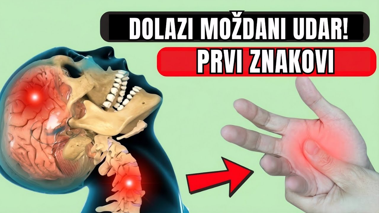 10 ŠOKANTNIH SIMPTOMA MOŽDANOG UDARA KOJE MORATE ZNATI NAKON 50. GODINE