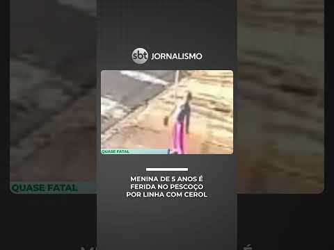 Linha de cerol fere menina de 5 anos no pescoço em rua de Franca (SP) | #SeLigaBrasil