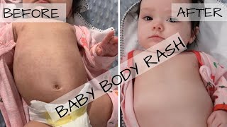 HOW TO GET RID OF BABY BODY RASH | 4 MONTHS OLD BABY.