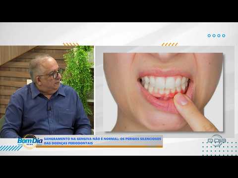 O Dia TV