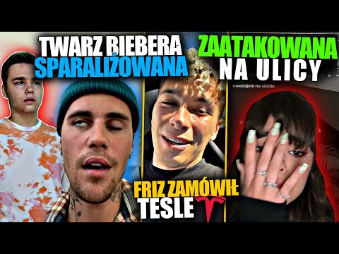 PATRYCJA MOŁCZANOW ZAATAKOWANA na ULICY, FRIZ ZAMÓWIŁ TESLE, TWARZ JUSTINA BIEBERA SPARALIŻOWANA