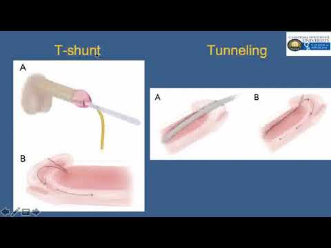 Sub-Intern Presentations