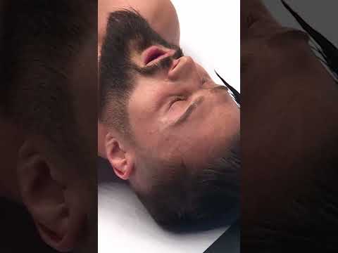 AŁA! Łączymy się w bólu z Ferrarim 😥 #famemma #fame20