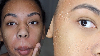 How to get rid of dry skin! Literally RUB all the DEAD SKIN off your FACE!