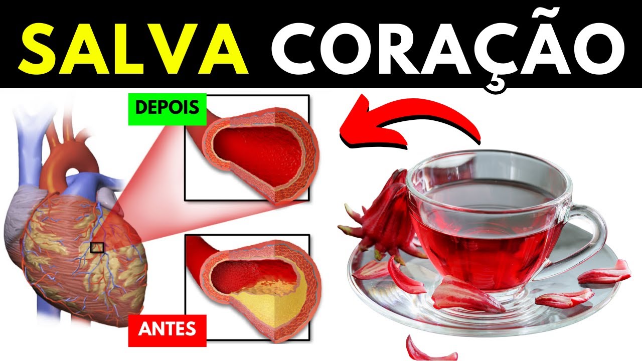 MELHORES CHÁS PARA LIMPAR as ARTÉRIAS, Normalizar a PRESSÃO ALTA e Prevenir o ATAQUE CARDÍACO