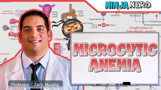 Microcytic Anemia | Clinical Medicine