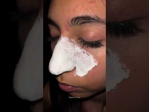 Nose Strips for Blackheads Removal,Deep Cleansing Pore Strips|Link in Bio😍 #viral #trending