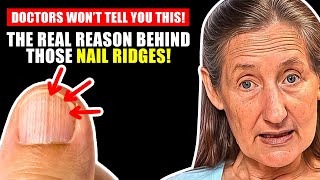 That's The REAL Cause of VERTICAL RIDGES On Your Nails | Barbara O'neill
