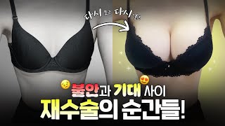 가슴 재수술...결국 다시했습니다 ㅣ 😎솔직 후기