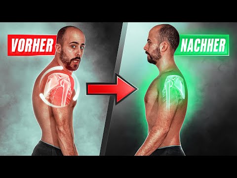 Correcting rounded shoulders (pulling shoulders back does NOTHING!)