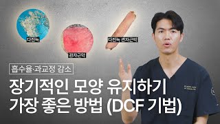 장기적인 모양 유지하기 가장 좋은 방법 (DCF기법) | 늑떼선생김현주
