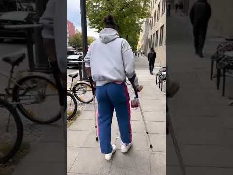 Ich habe Schläuche in meinem Bein 😳