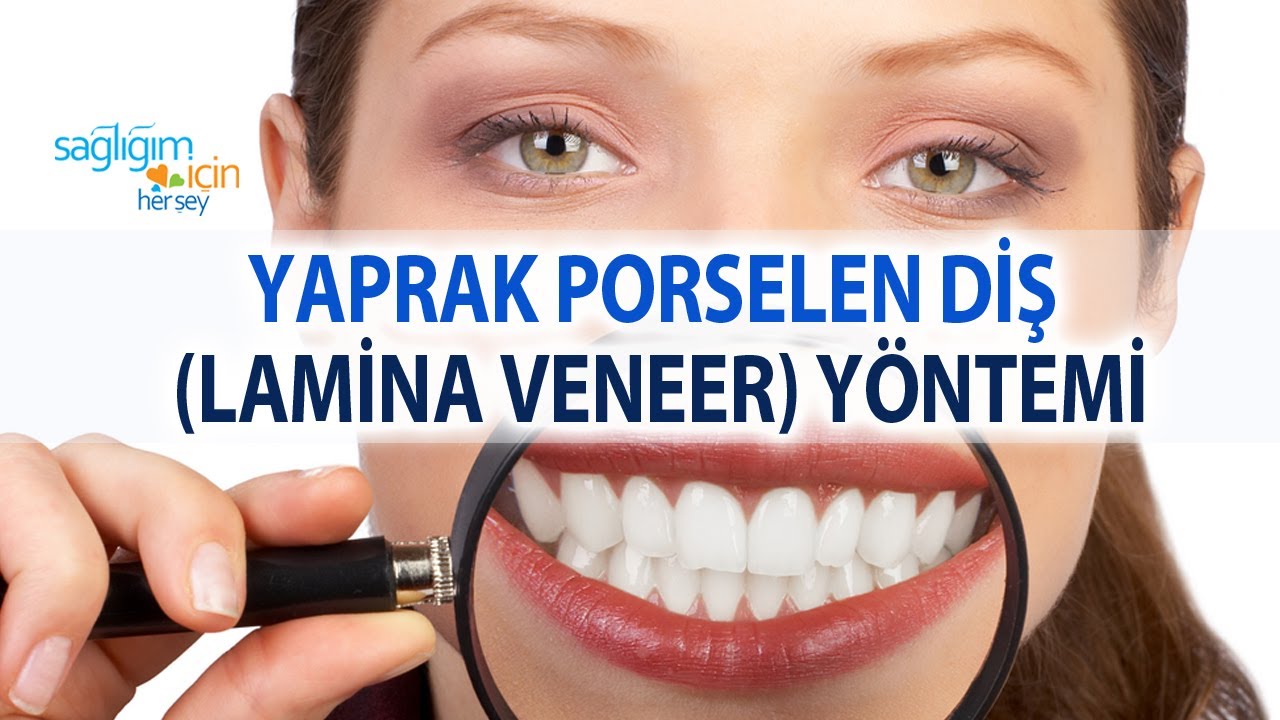 Yaprak Porselen Diş (Lamina Veneer) Yöntemi