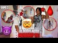 Aus Der Nase Tropft BLUT Bei Diesem Mini Basketball 1 Gegen 1 Die Reguläre Saison Wird Ernst