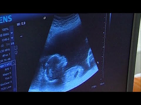 Vem är mamma till ett barn? Laglig syn på surrogatmödraskap kan ändras - Nyheterna (TV4)