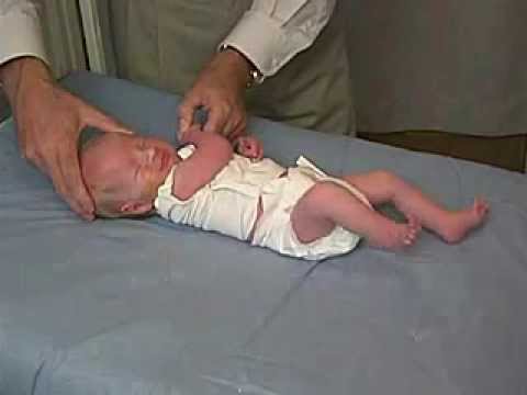 09/23. Clinical Pediatrics:  Hypotonia 3