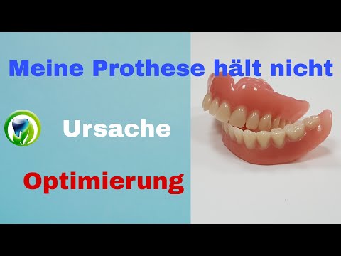 Warum saugt/hält meine Totalprothese nicht? Wie entsteht der Saugeffekt? Prothese optimieren