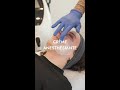 Les 4 étapes clés du microneedling ✨