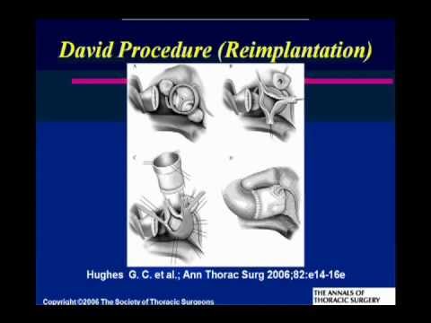 Cardiology Grand Rounds: Repairing Valves: Why and Why Not?