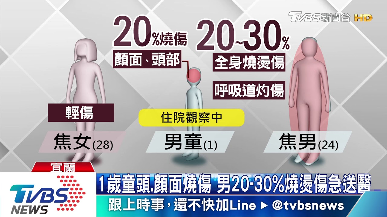 小吃店廚房備料　瓦斯漏氣突爆炸釀3傷