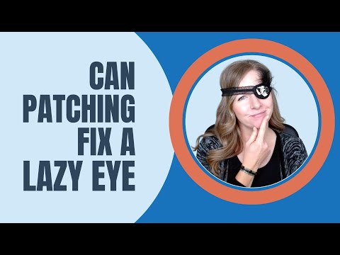 Can Patching Fix A Lazy Eye or Strabismus?