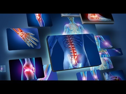Artroza tratamentului medical la genunchi