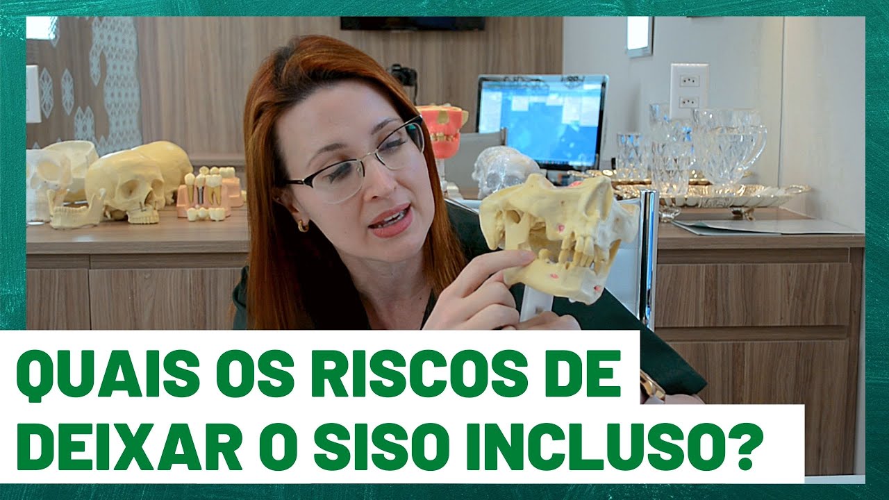 TIRAR OU NÃO TIRAR O SISO INCLUSO? DRA. DANIELLE SALES