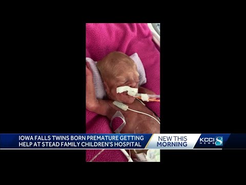 Iowans rally behind twins born at just 23 weeks