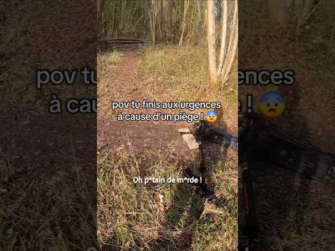 Je fini aux urgences après une chute en trottinette ! 😰 #sensibilisation #ambulance #trottinette