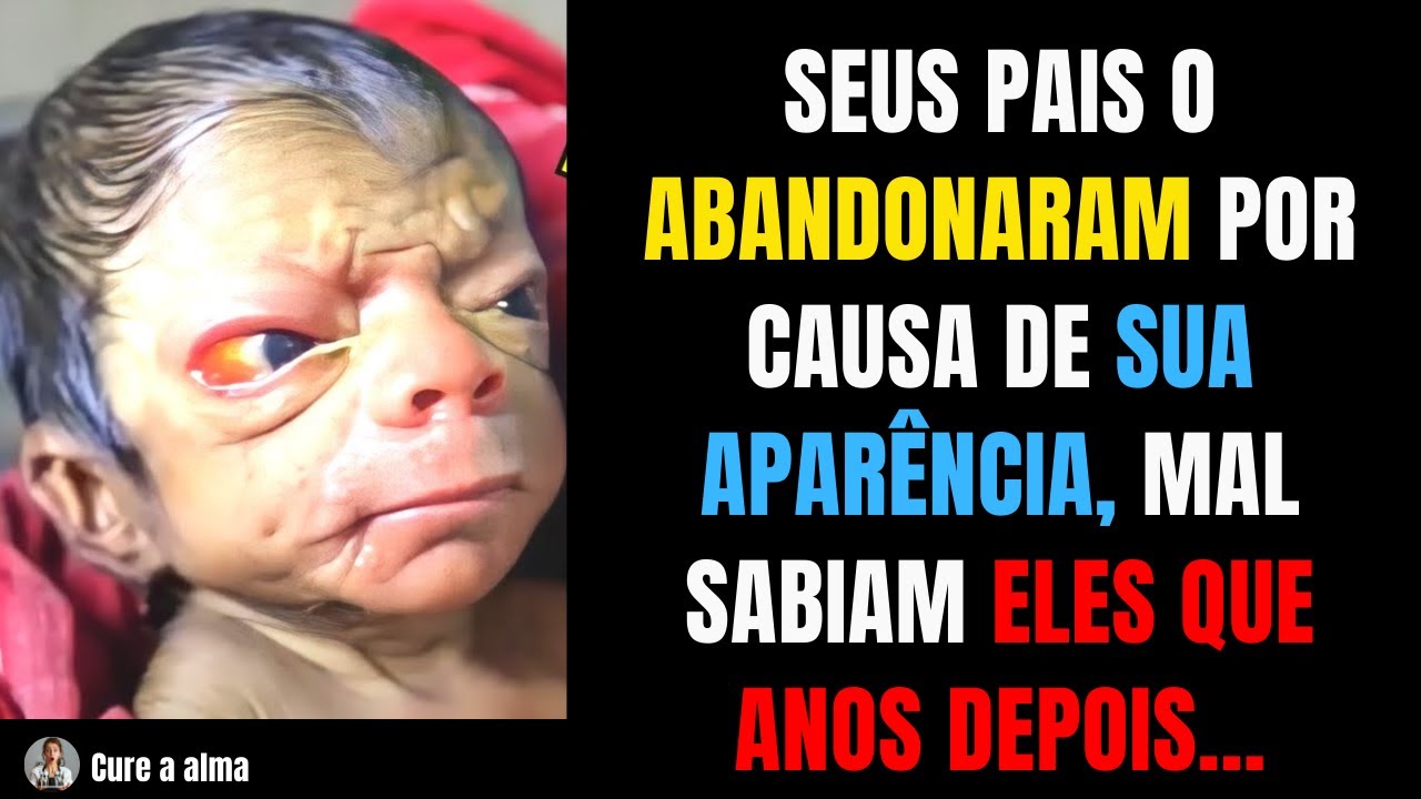 Seus pais o abandonaram por causa de sua aparência, Mal sabiam eles que anos depois...