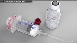 ACP   Autologous Conditioned Plasma