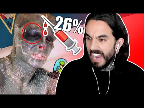 The BLACK ALIEN se OPERA los OJOS y QUEDAREMOS el MES que VIENE 😲