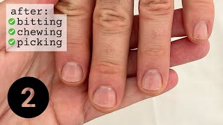 How to re-start your nails (after falling off the wagon) WEEK 2