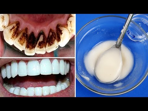 Why Does My Tooth Harms When I Bite Down? – Keeping Your Feline's Teeth ...