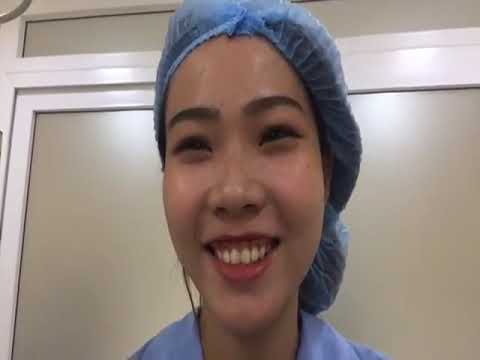  Video nâng mũi S Line cấu trúc sụn...