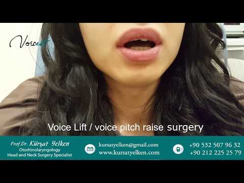 Ses Feminizasyon Ameliyatı